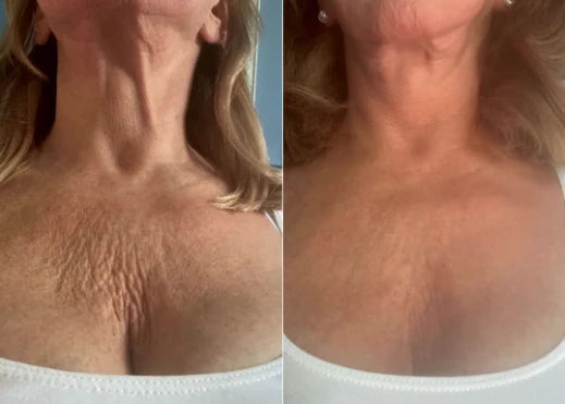 Linda M., 61